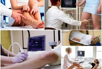 Varikozės venos diagnostikos metodai