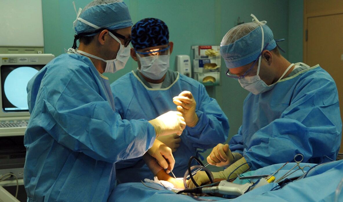 chirurginis varikozinių venų gydymas