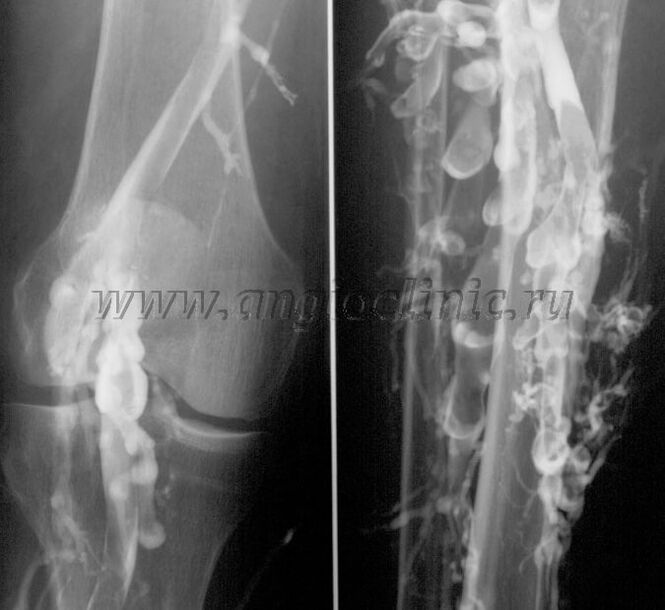 Ultragarsinis skenavimas